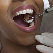 Image of Crowns & Bridges